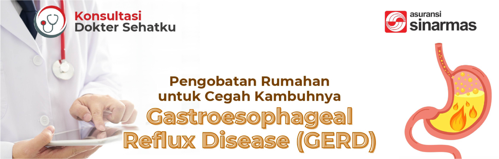 Pengobatan Rumahan untuk Cegah Kambuhnya Gastroesophageal Reflux Disease (GERD)